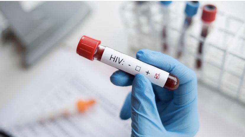 В Лисаковске растет число заболеваемости по ВИЧ инфекции